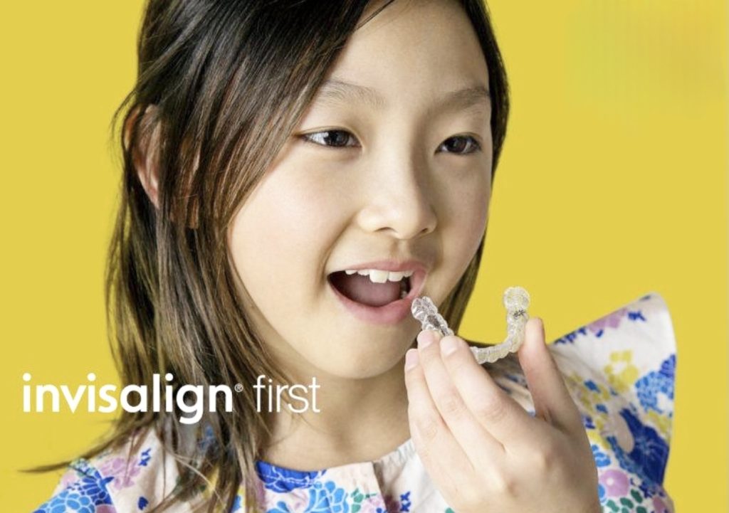 Invisalign First Girl