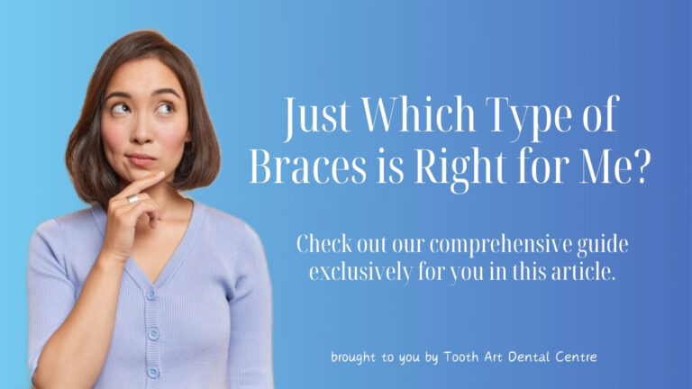Choosing the Right Type of Dental Braces