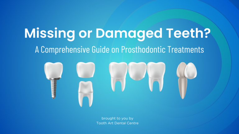Missing or Damaged Teeth? A Comprehensive Guide to Prosthodontic Treatments