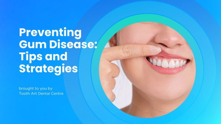Preventing Gum Disease: Tips and Strategies
