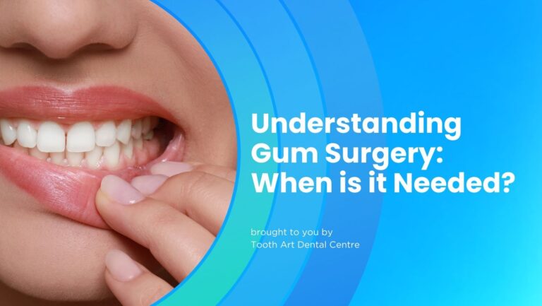 Understanding Gum Surgery: When is it Needed?