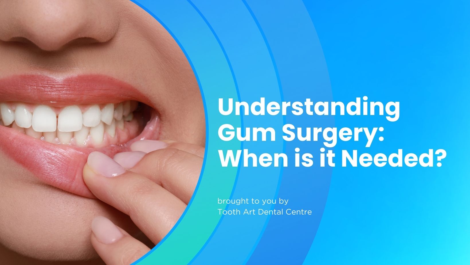 Gum surgery