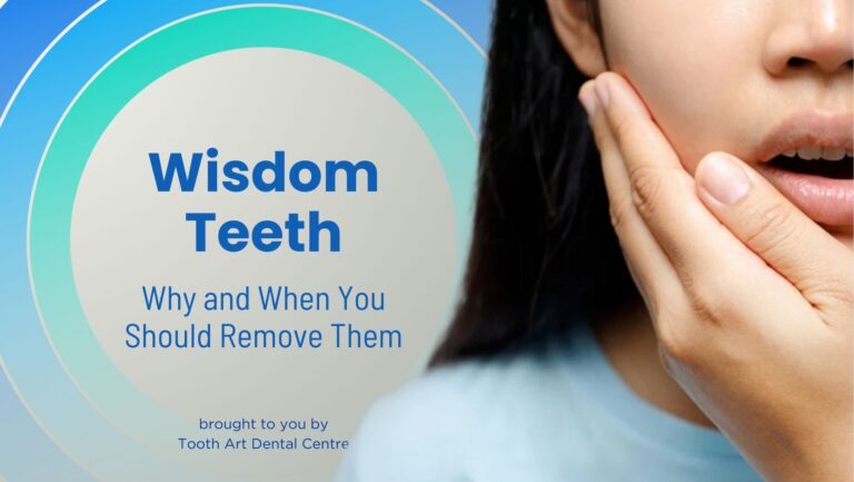 Wisdom Teeth: Why and When You Should Remove Them
