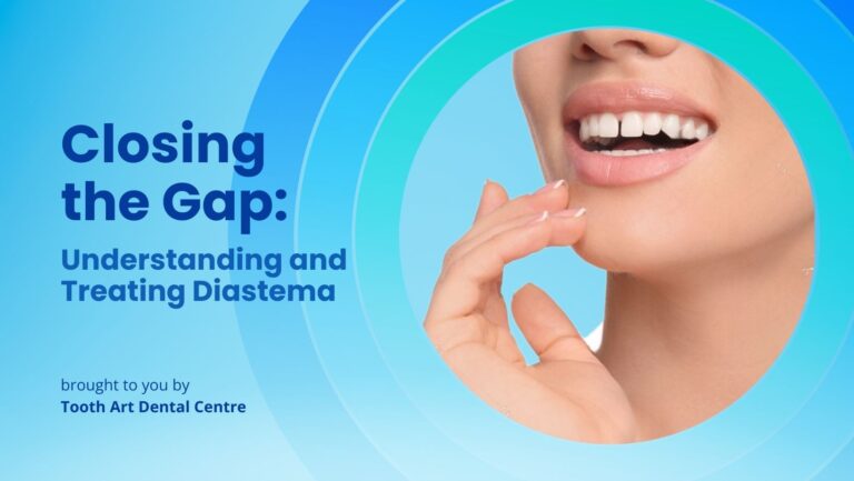 Closing the Gap: Understanding and Treating Diastema