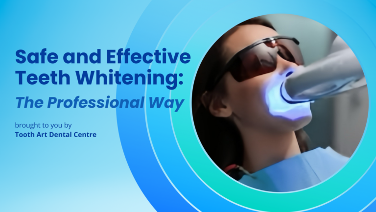 Safe and Effective Teeth Whitening: The Professional Way