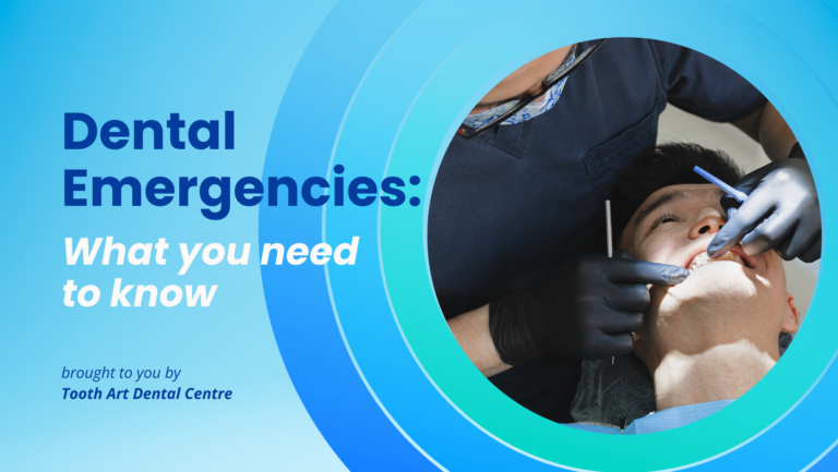 Dental Emergencies: What you need to know